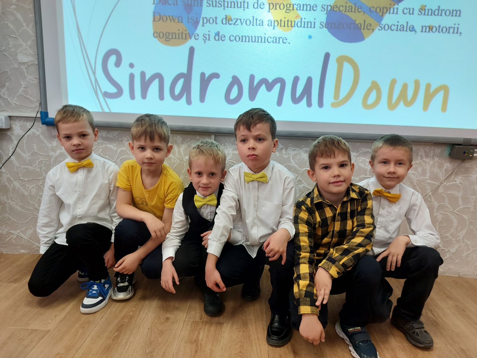 Sindromul Down